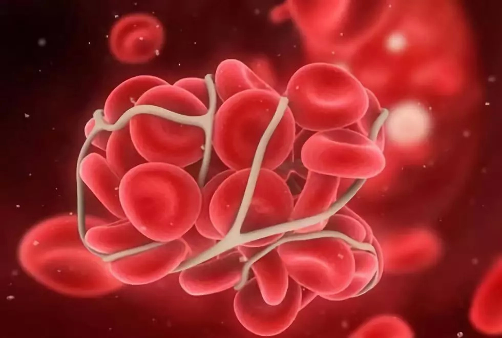 Prolonged travel increases the risk of venous thromboembolism