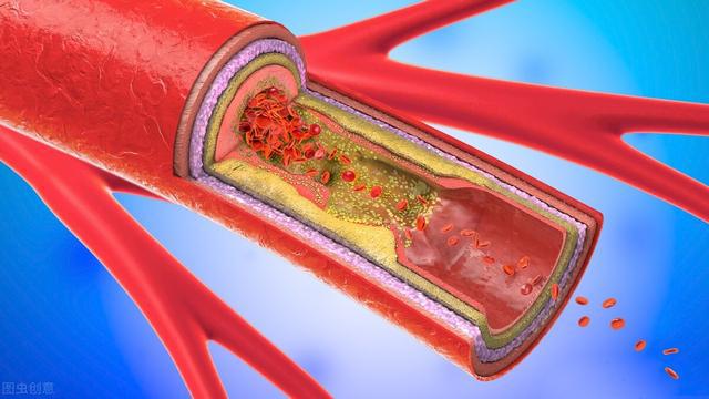 The Dangers Of Blood Clots