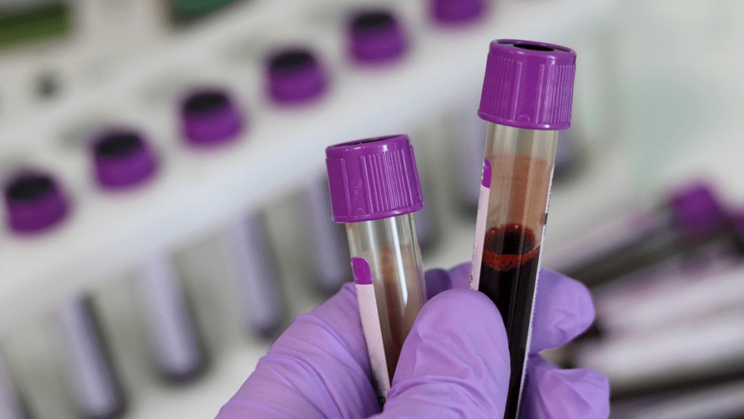 Blood coagulation tests for APTT and PT reagent
